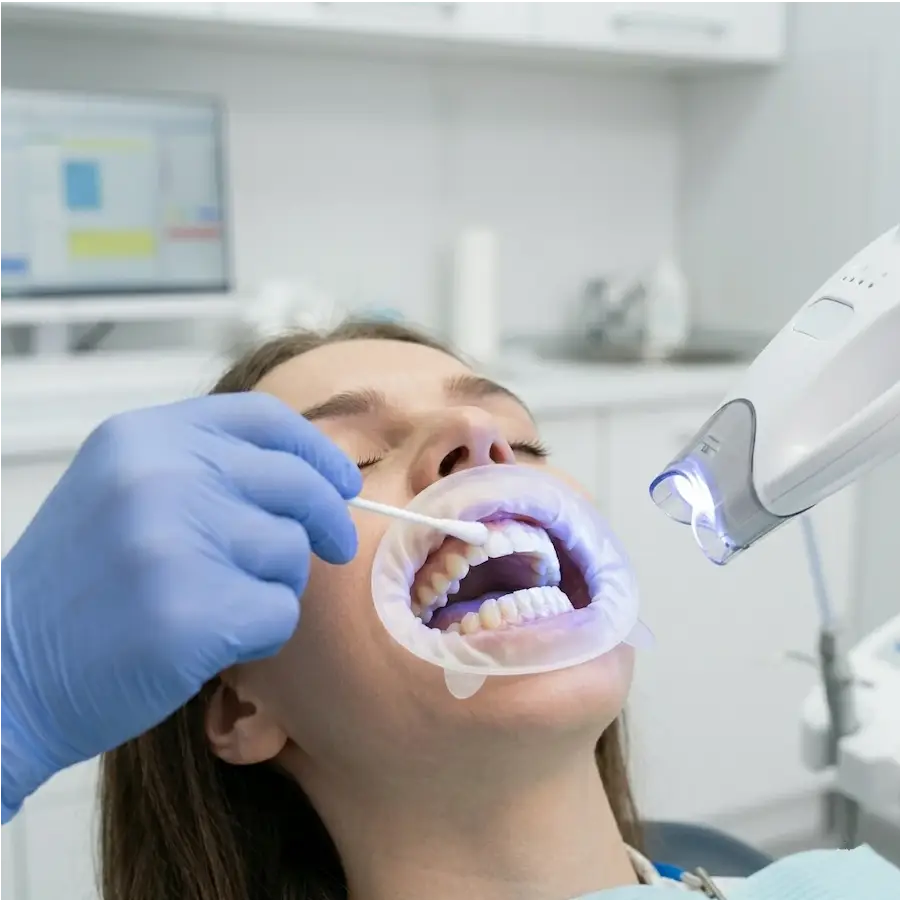 Відбілювання зубів Zoom 4 в Одесі — до 8 тонів світліше