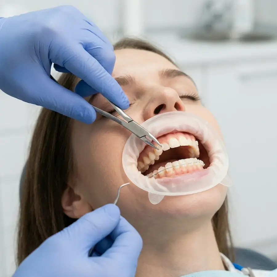 Ортодонтія в Одесі — брекети та елайнери Invisalign